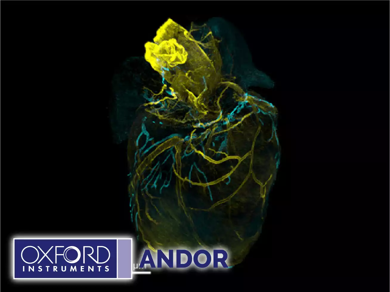 Andor High-Speed Confocal with 3D Super-Resolution